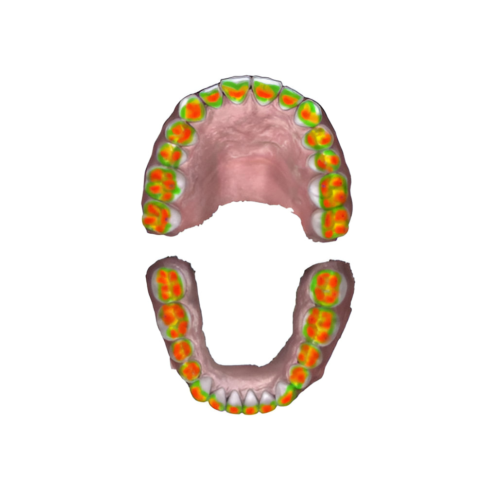 Scanner