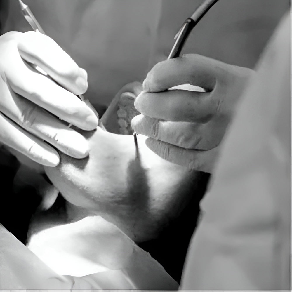 Oral Surgery