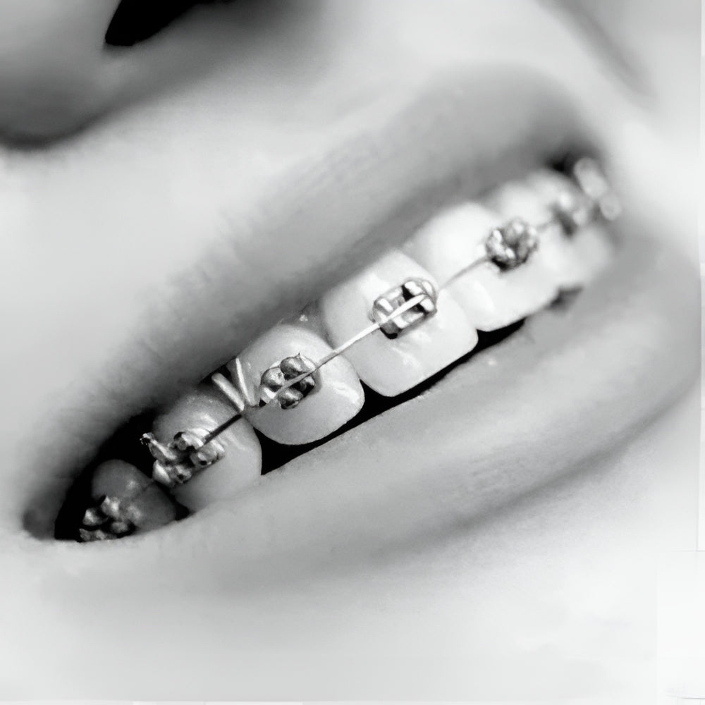 Orthodontics