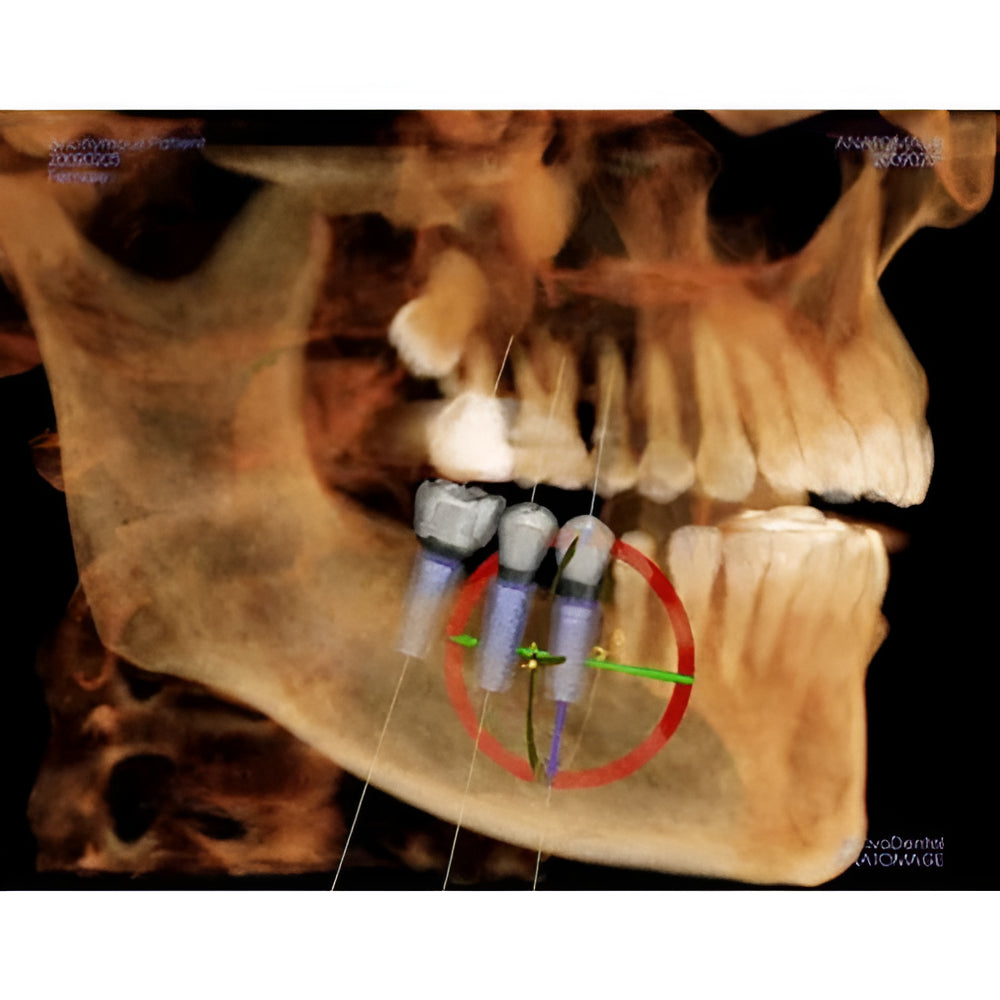 Cone Beam
