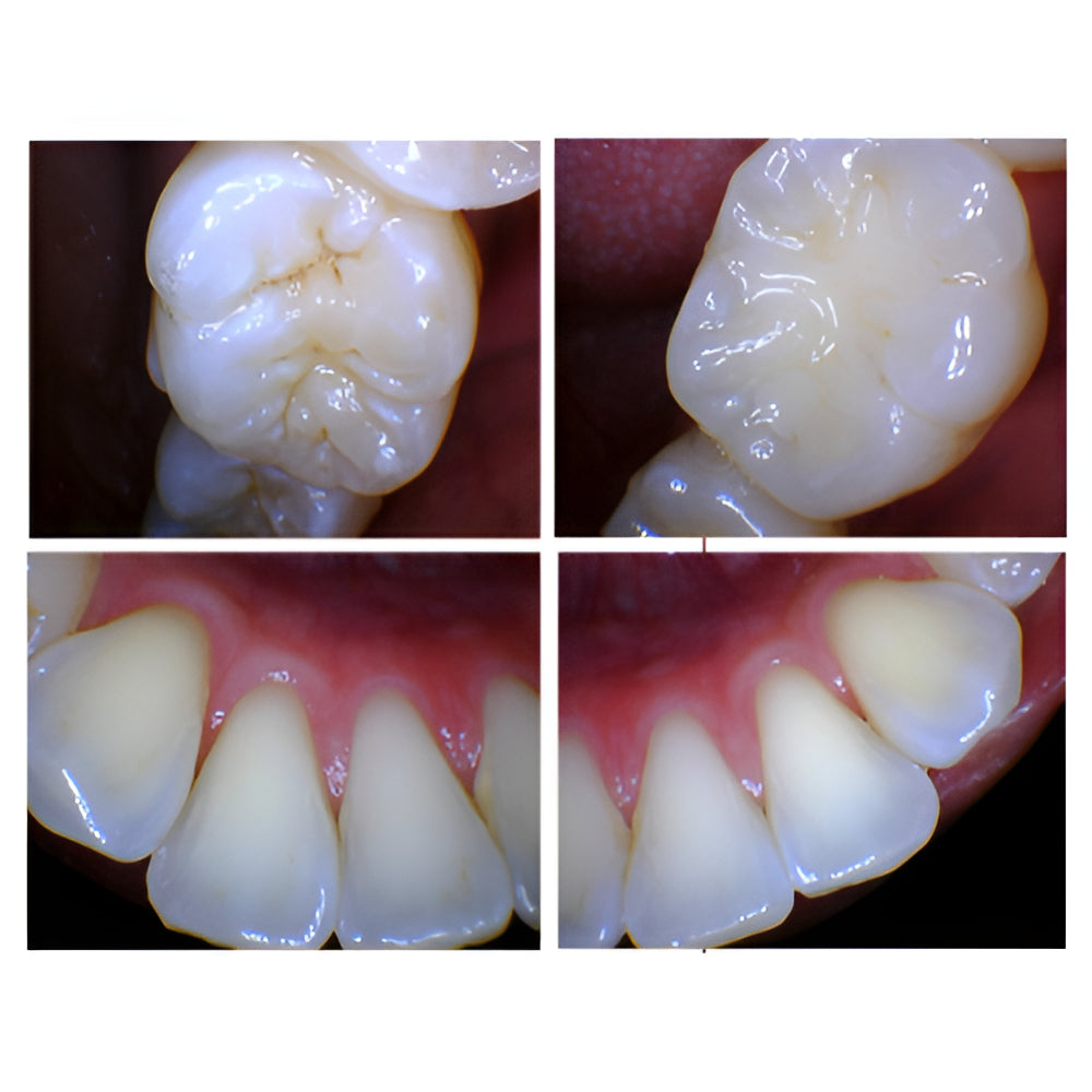 NEW iCAM IntraOral Camera with Warranty