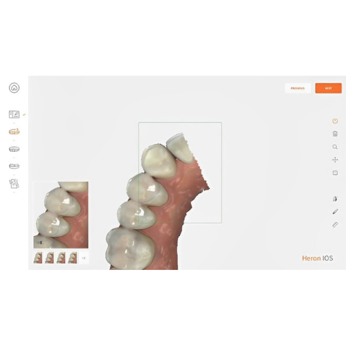 3Disc Heron Intra Oral Scanner with Laptop, Warranty