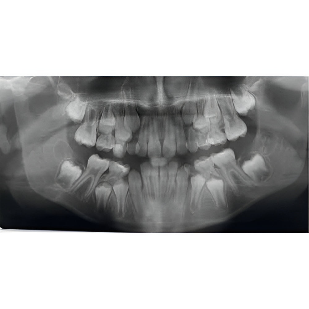 Acteon XMind Trium Pan + Ceph + CBCT (12x8 FOV)