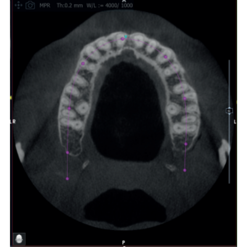 Acteon XMind Optima Pan + CBCT Wall Mount (12x10 FOV)