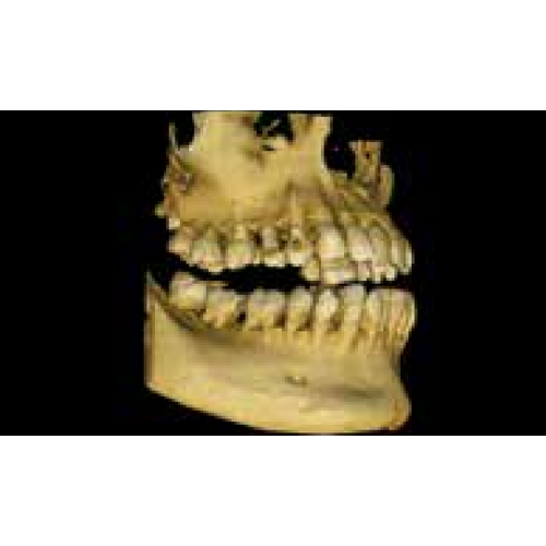Carestream CS8100 Pan + CBCT (8x9 FOV)