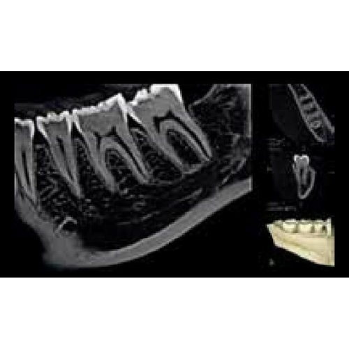Carestream CS8100 Pan + CBCT (8x9 FOV)