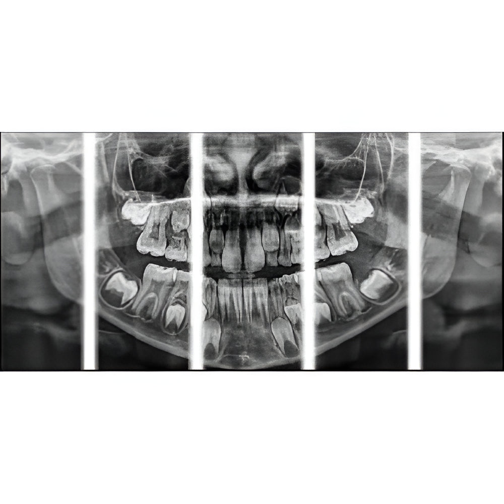 Carestream CS8100 Pan + CBCT (8x9 FOV)