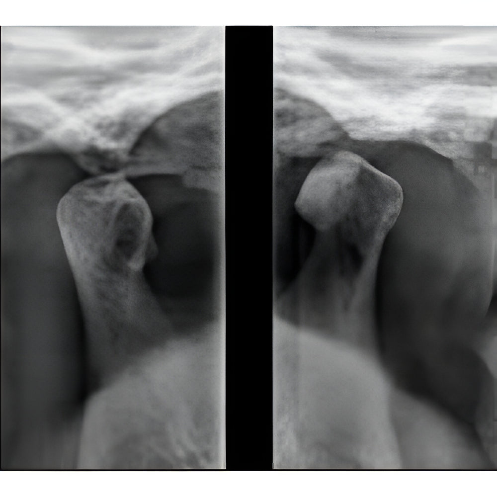 Carestream CS8100 Pan + CBCT (8x9 FOV)