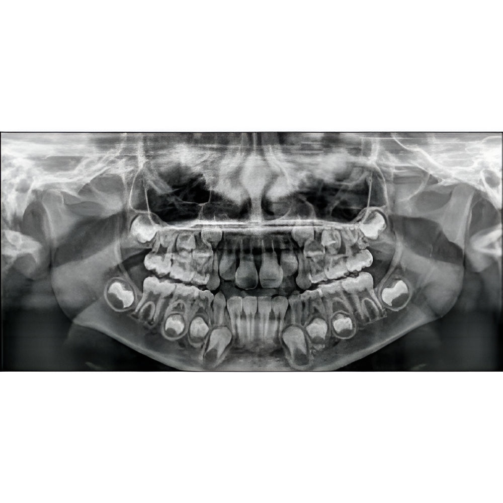 Carestream CS8100 Pan + CBCT (8x9 FOV)
