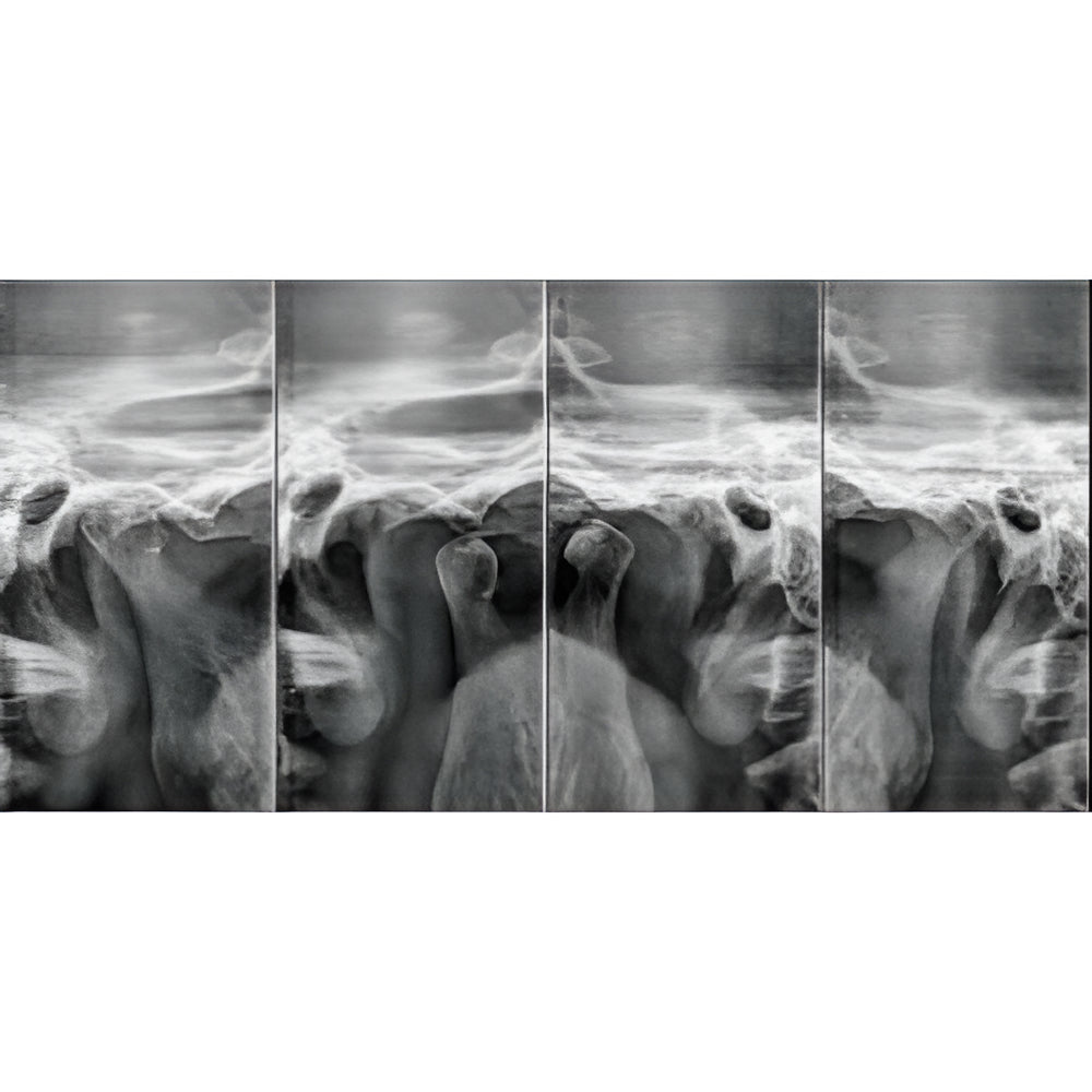 Carestream CS8100 Pan + CBCT (8x9 FOV)