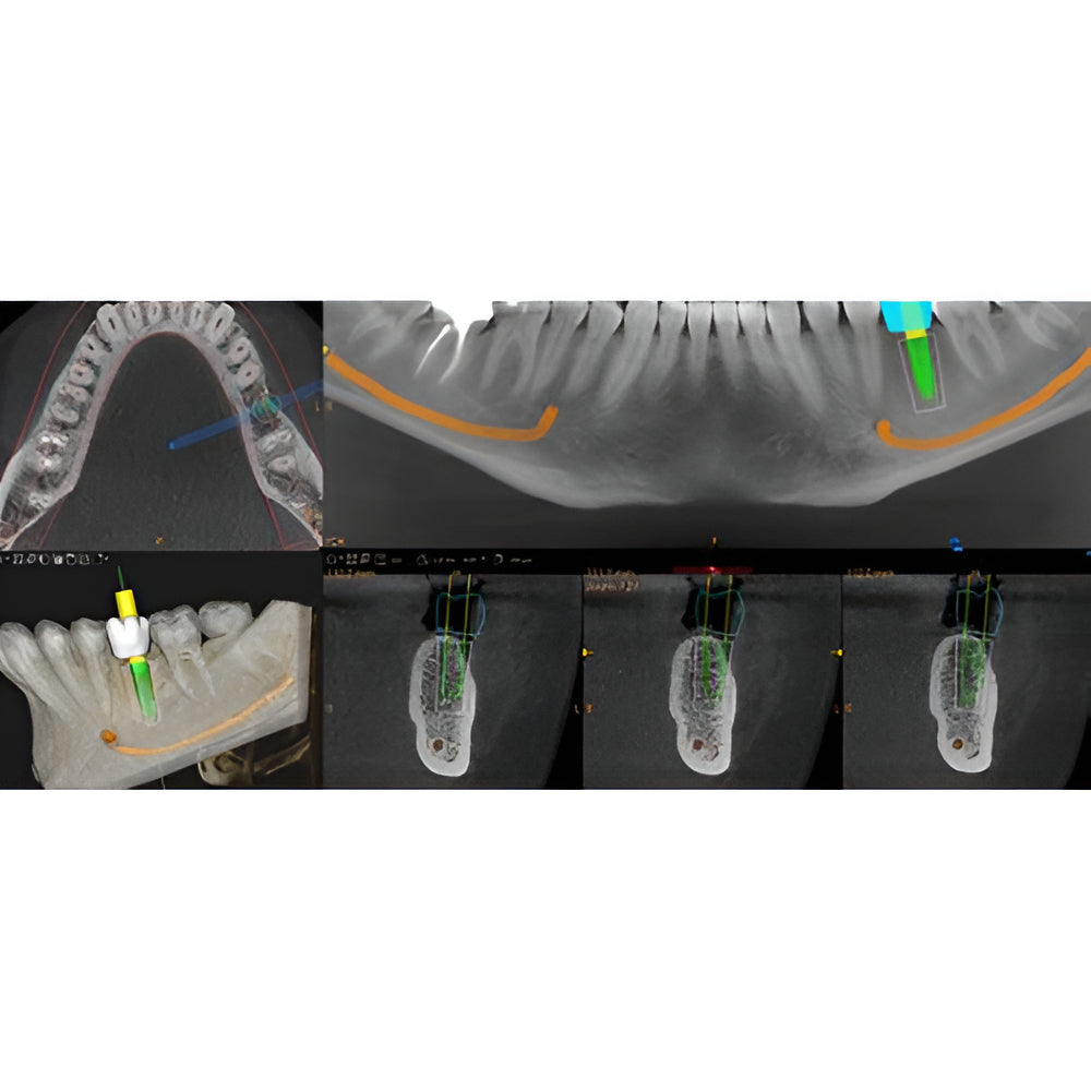 Carestream CS8200 Advanced Pan + CBCT (12x10 FOV)