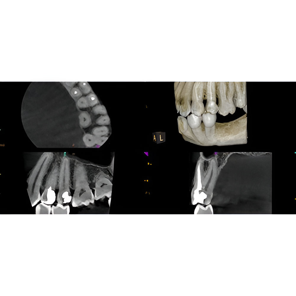 Carestream CS8200 Advanced Pan + CBCT (12x10 FOV) with PC, Software, Installation, Shipping and Warranty