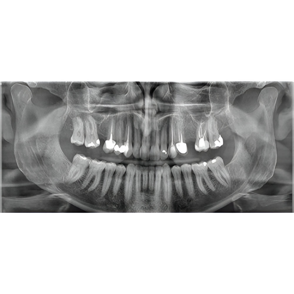 Carestream CS8200 Advanced Pan + CBCT (12x10 FOV) with PC, Software, Installation, Shipping and Warranty