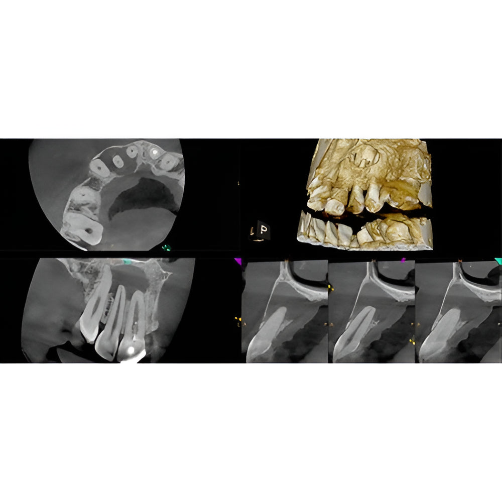 Carestream CS8200 Advanced Pan + CBCT (12x10 FOV) with PC, Software, Installation, Shipping and Warranty