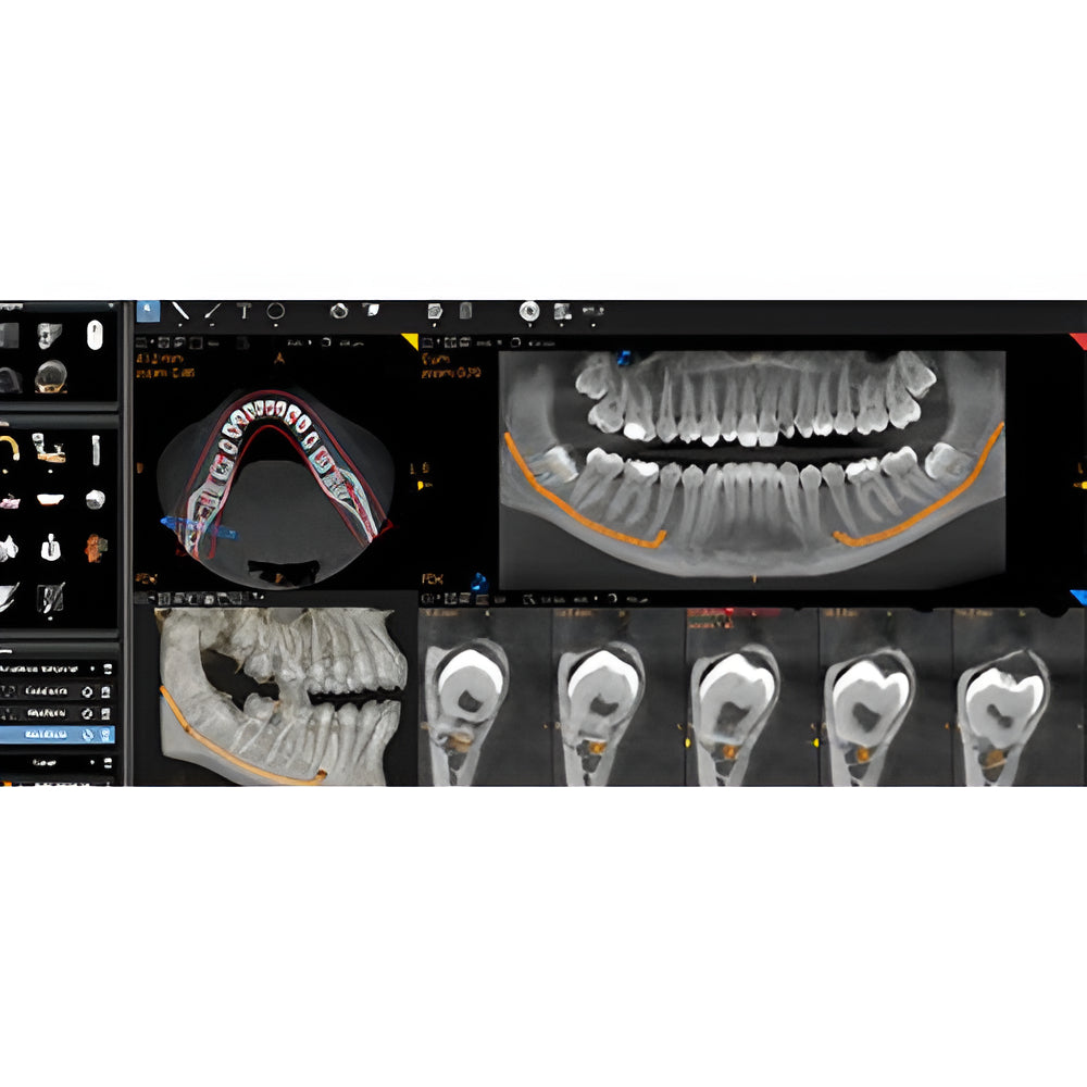 Carestream CS8200 Advanced Pan + CBCT (12x10 FOV)