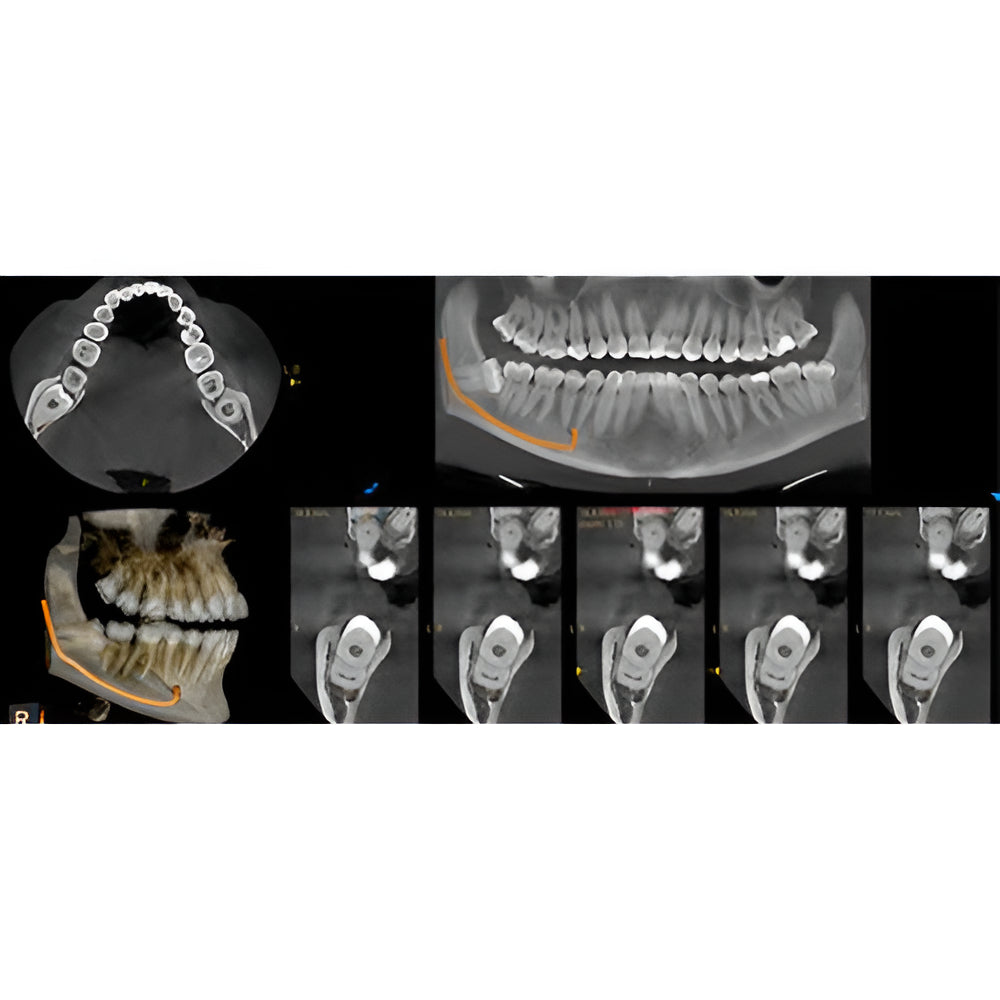 Carestream CS8200 Advanced Pan + CBCT (12x10 FOV) with PC, Software, Installation, Shipping and Warranty