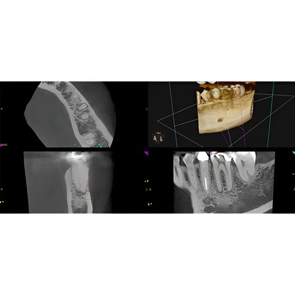 Carestream CS8200 Advanced Pan + CBCT (12x10 FOV) with PC, Software, Installation, Shipping and Warranty