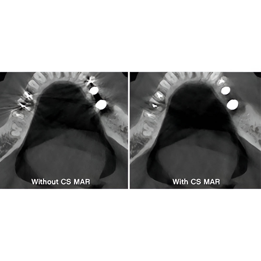 Carestream CS8200 Advanced Pan + CBCT (12x10 FOV) with PC, Software, Installation, Shipping and Warranty