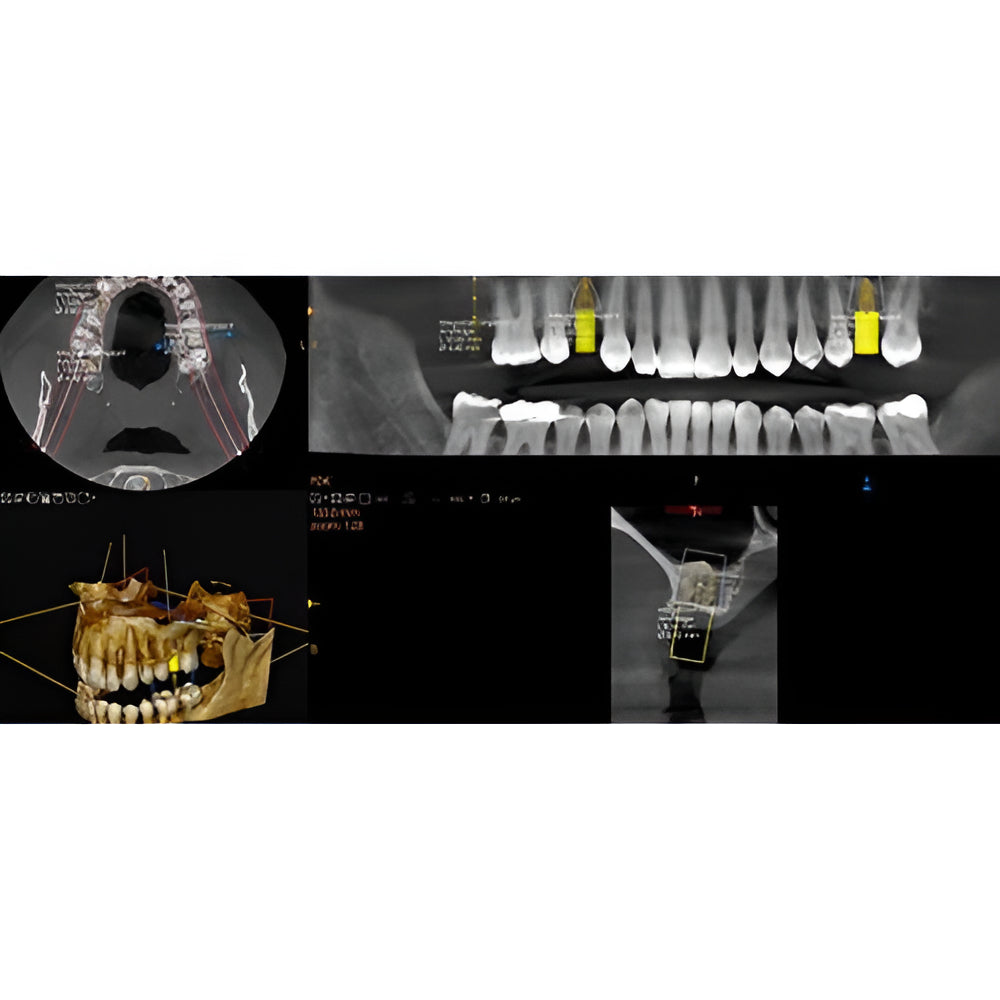 Carestream CS8200 Advanced Pan + CBCT (12x10 FOV) with PC, Software, Installation, Shipping and Warranty