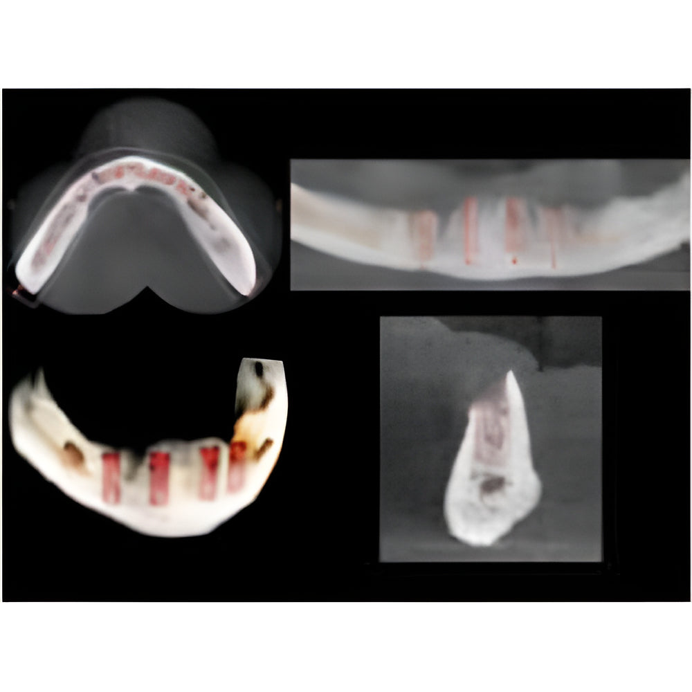 Carestream CS9000 Pan + CBCT (5x5 FOV)