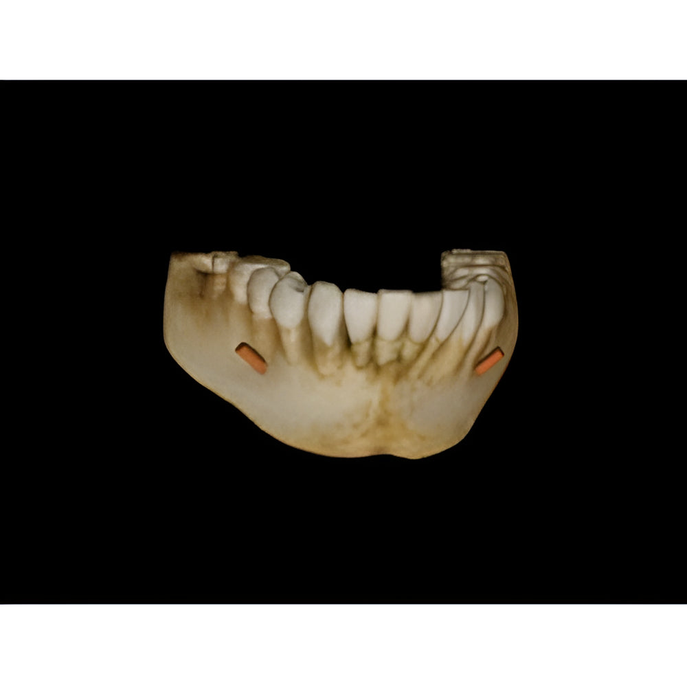 Carestream CS9000 Pan + CBCT (5x5 FOV)