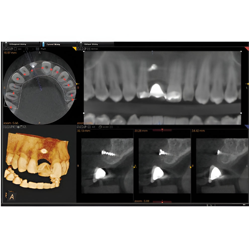Carestream CS9000 Pan + CBCT (5x5 FOV)