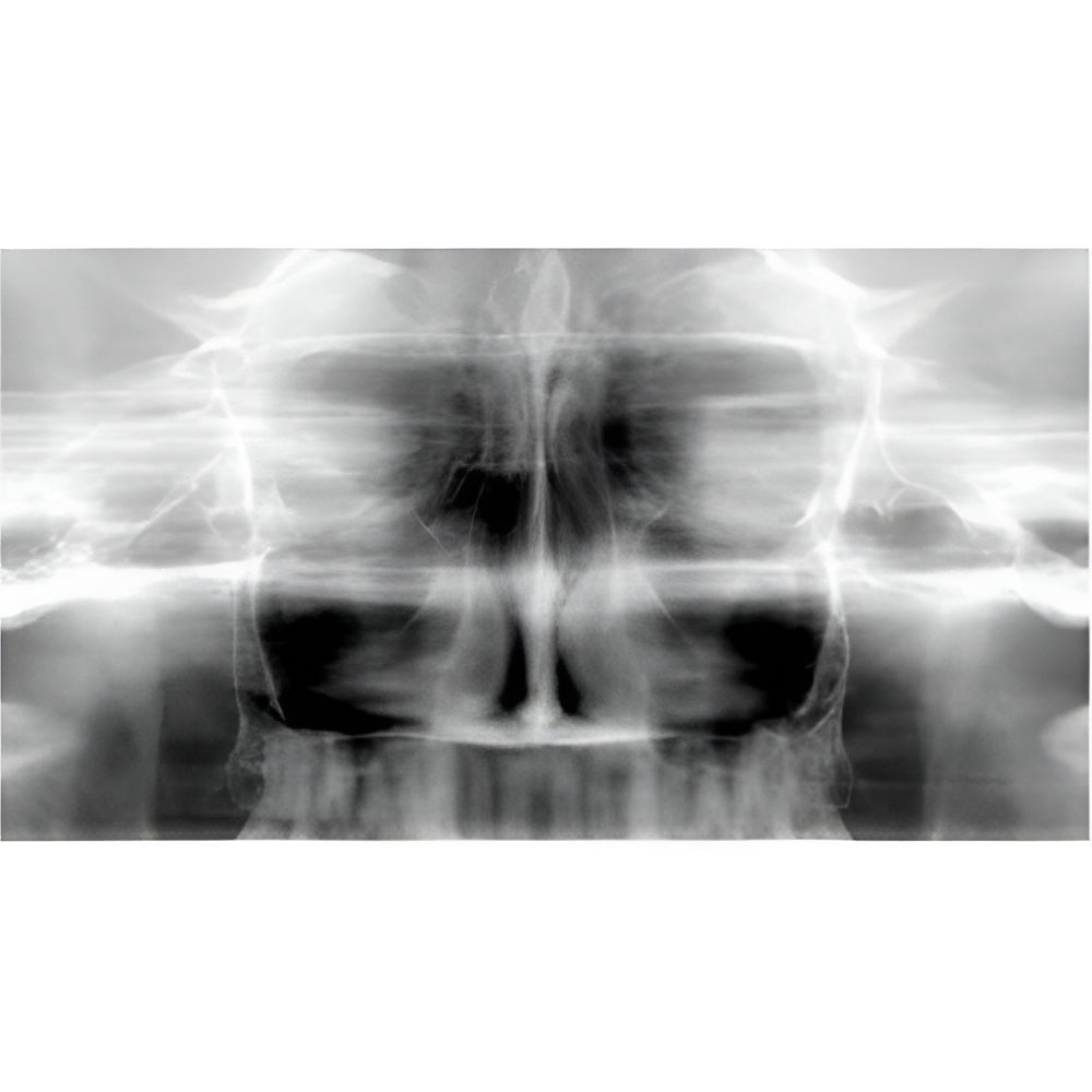 Carestream CS9000 Pan + CBCT (5x5 FOV)