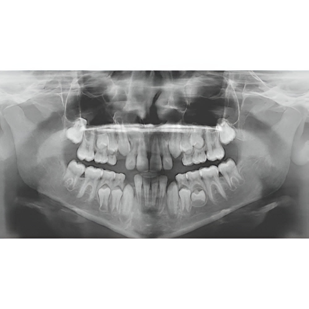 Carestream CS9000 Pan + CBCT (5x5 FOV)