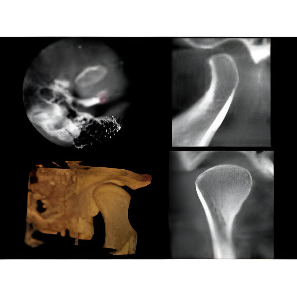 Carestream CS9000 Pan + CBCT (5x5 FOV)