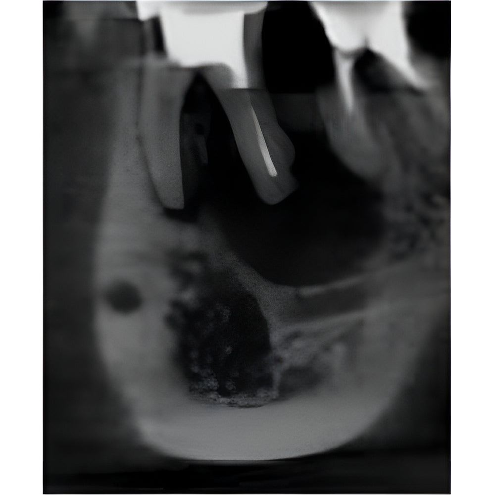 Carestream CS9000 Pan + CBCT (5x5 FOV)