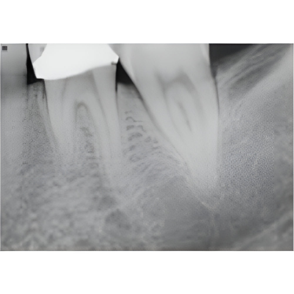 Carestream CS9000 Pan + CBCT (5x5 FOV)