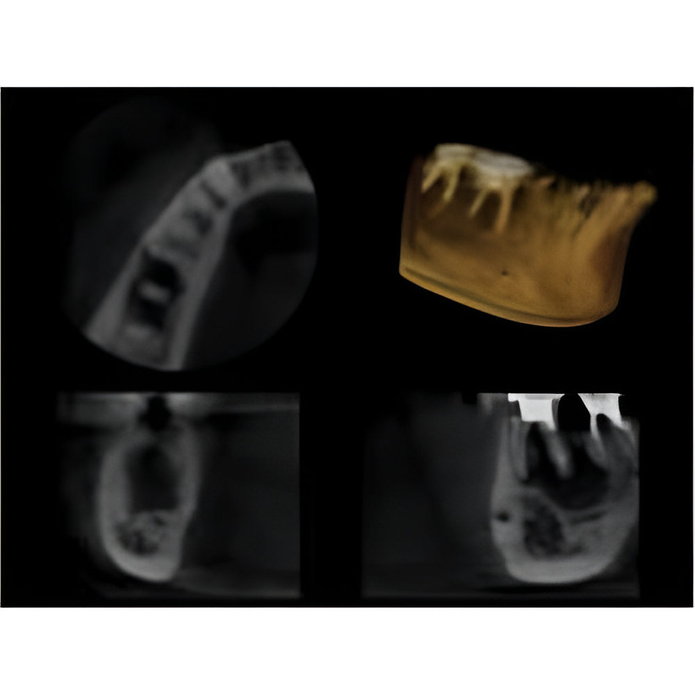 Carestream CS9000 Pan + CBCT (5x5 FOV)