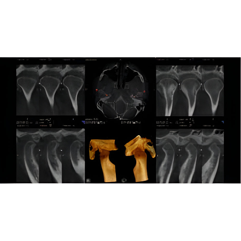 Carestream CS9300 Premium Pan + CBCT (17x13.5 FOV)