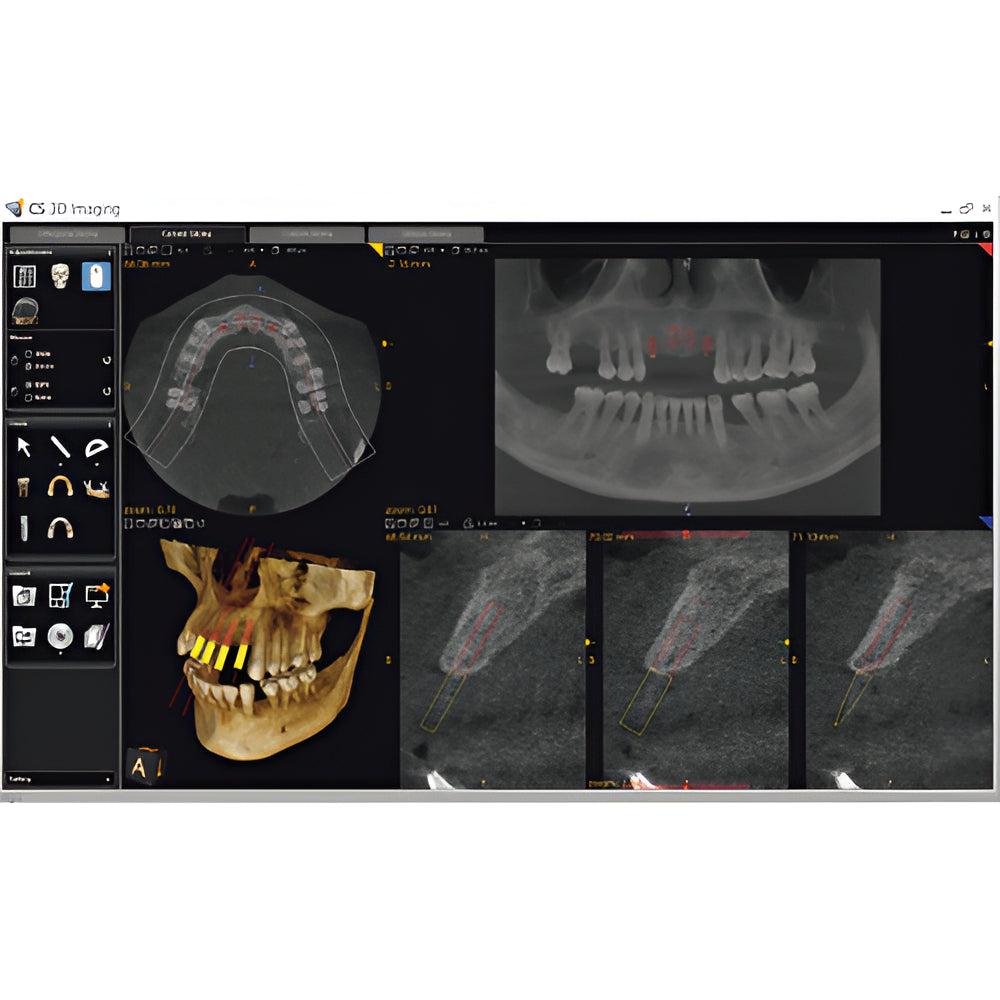 Carestream CS9300 Premium Pan + CBCT (17x13.5 FOV)