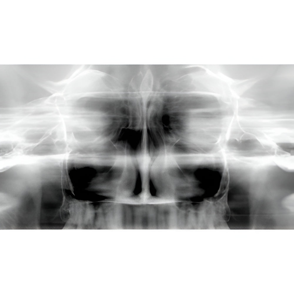 Carestream CS9300 Premium Pan + CBCT (17x13.5 FOV)