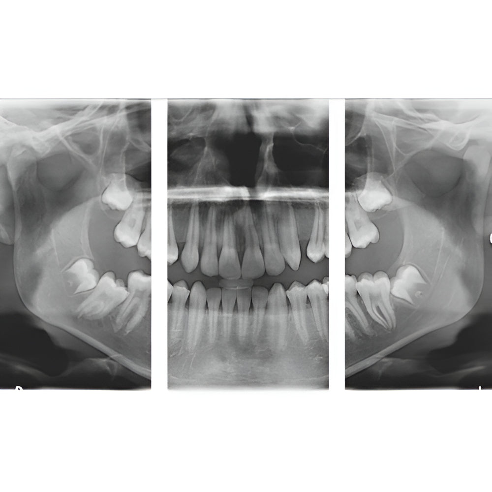 Carestream CS9300 Premium Pan + CBCT (17x13.5 FOV)