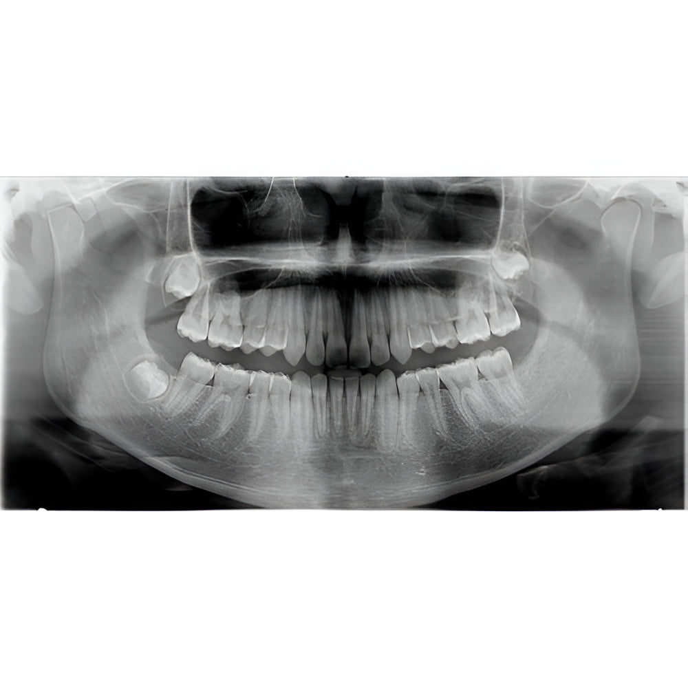 Carestream CS9300 Premium Pan + CBCT (17x13.5 FOV)