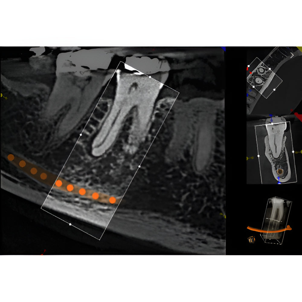 Carestream CS9300 Premium Pan + CBCT (17x13.5 FOV)