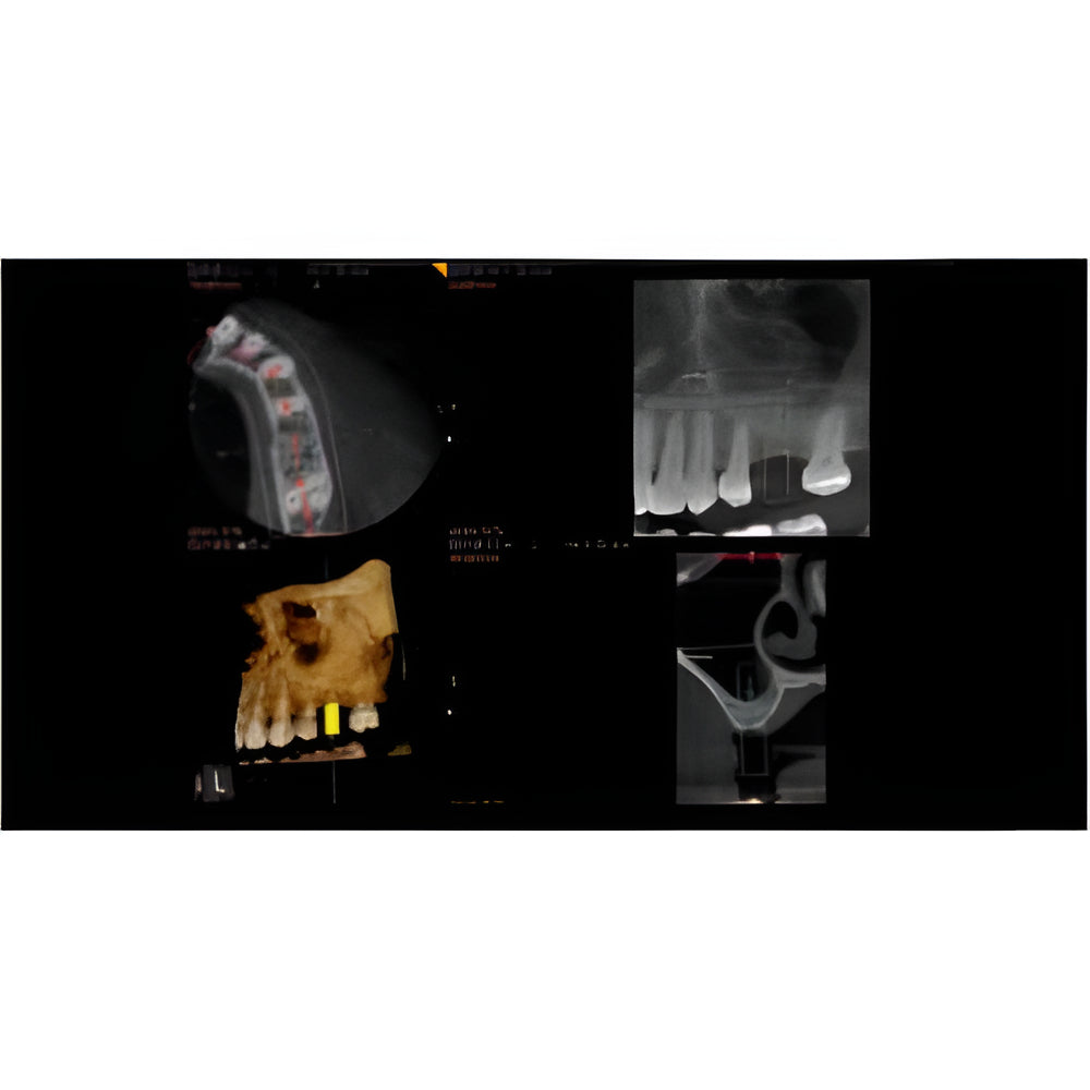 Carestream CS9300 Premium Pan + CBCT (17x13.5 FOV)