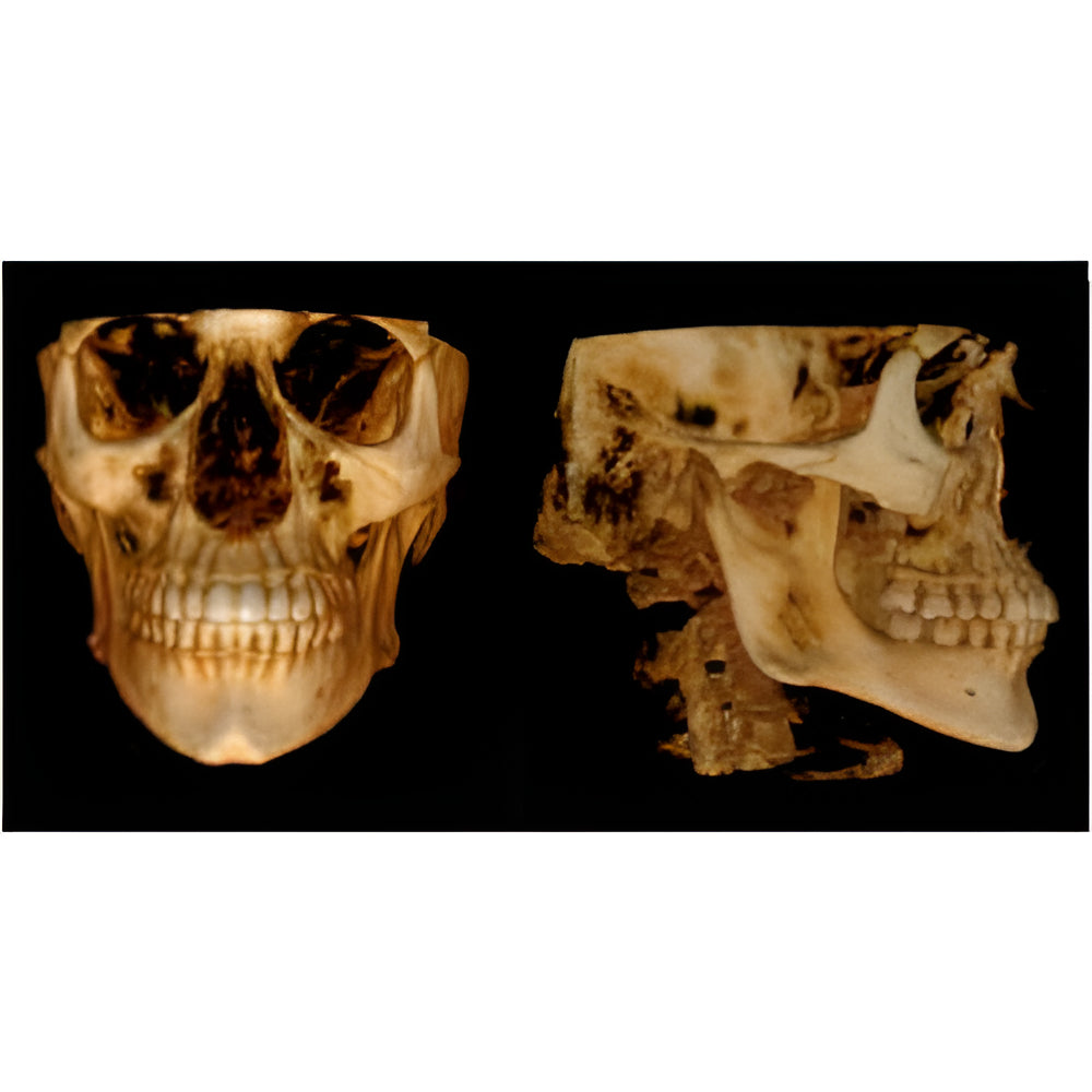 Carestream CS9300 Premium Pan + CBCT (17x13.5 FOV)