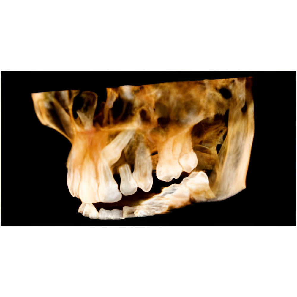 Carestream CS9300 Select Pan + CBCT (10x10 FOV)