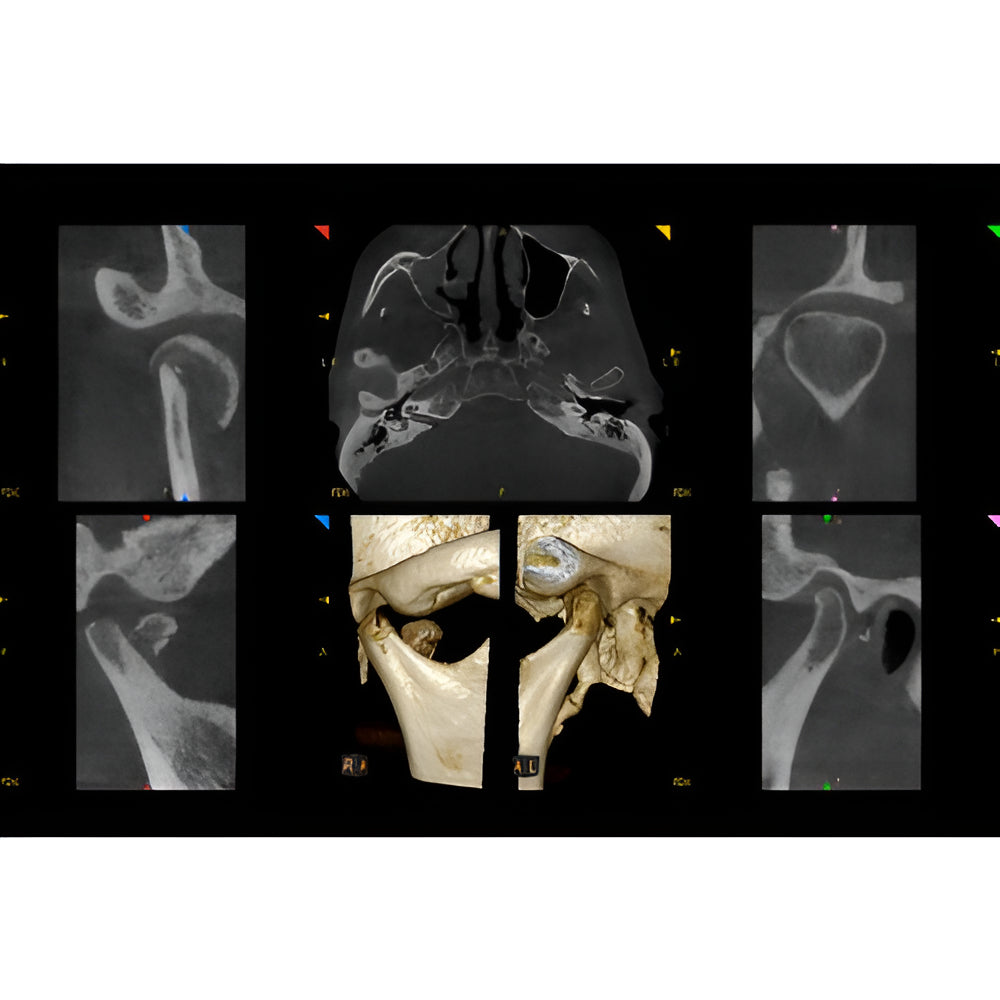 Carestream CS9600 Pan + CBCT (16x10 FOV)
