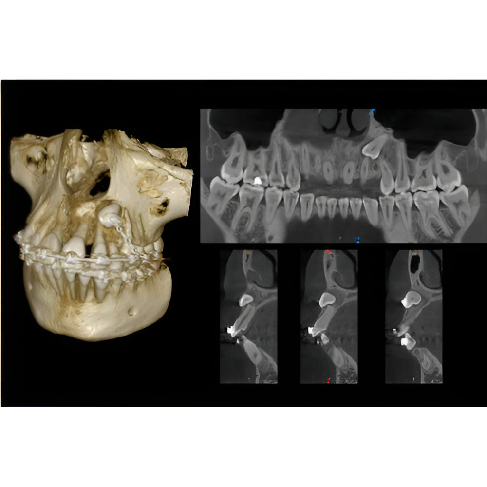 Carestream CS9600 Pan + CBCT (16x10 FOV)