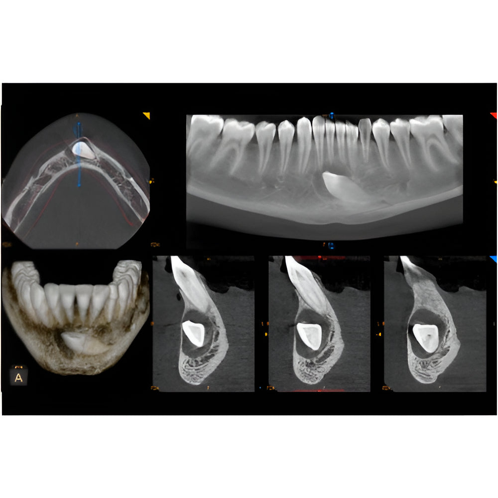 Carestream CS9600 Pan + CBCT (16x10 FOV)