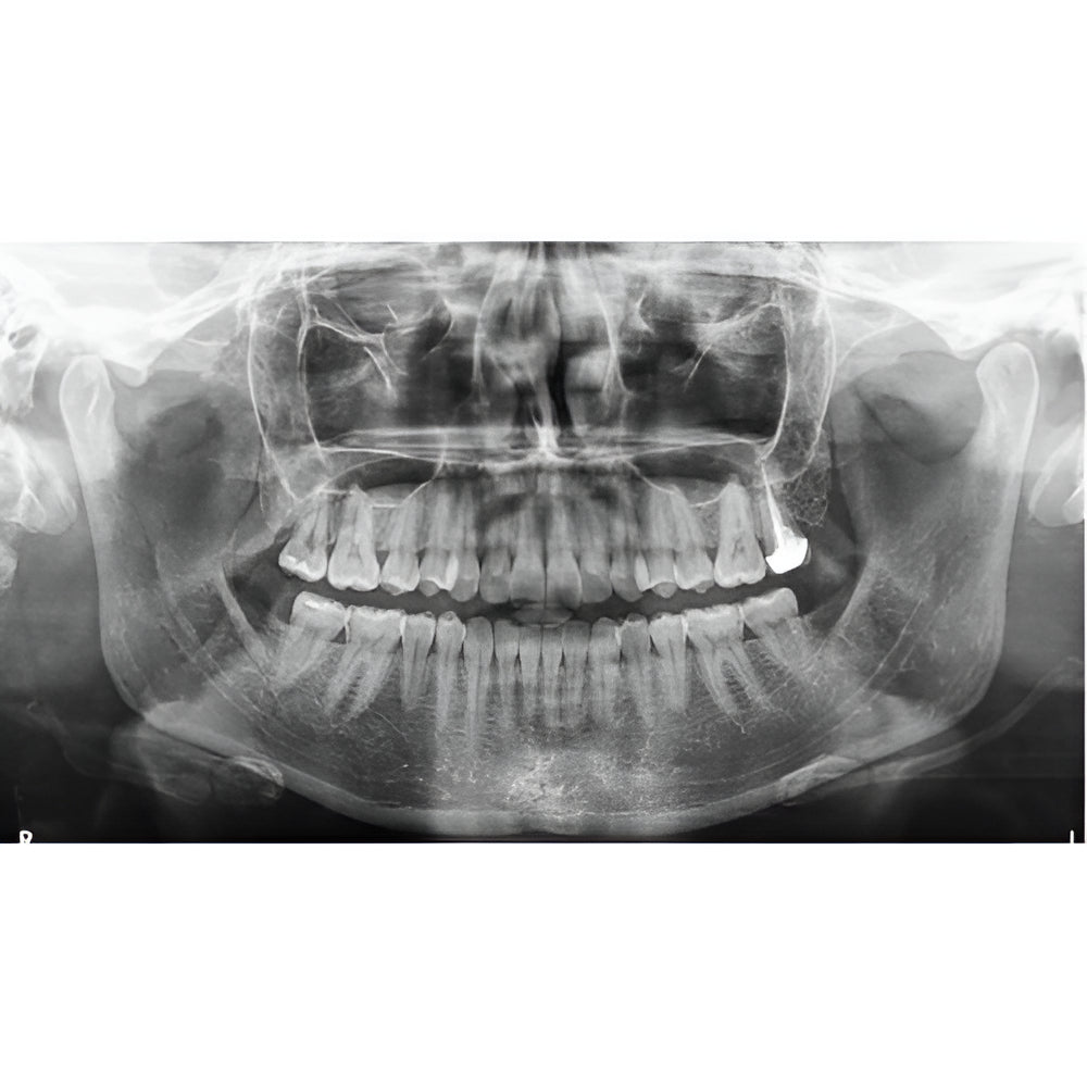 Carestream CS9600 Pan + CBCT (16x10 FOV)