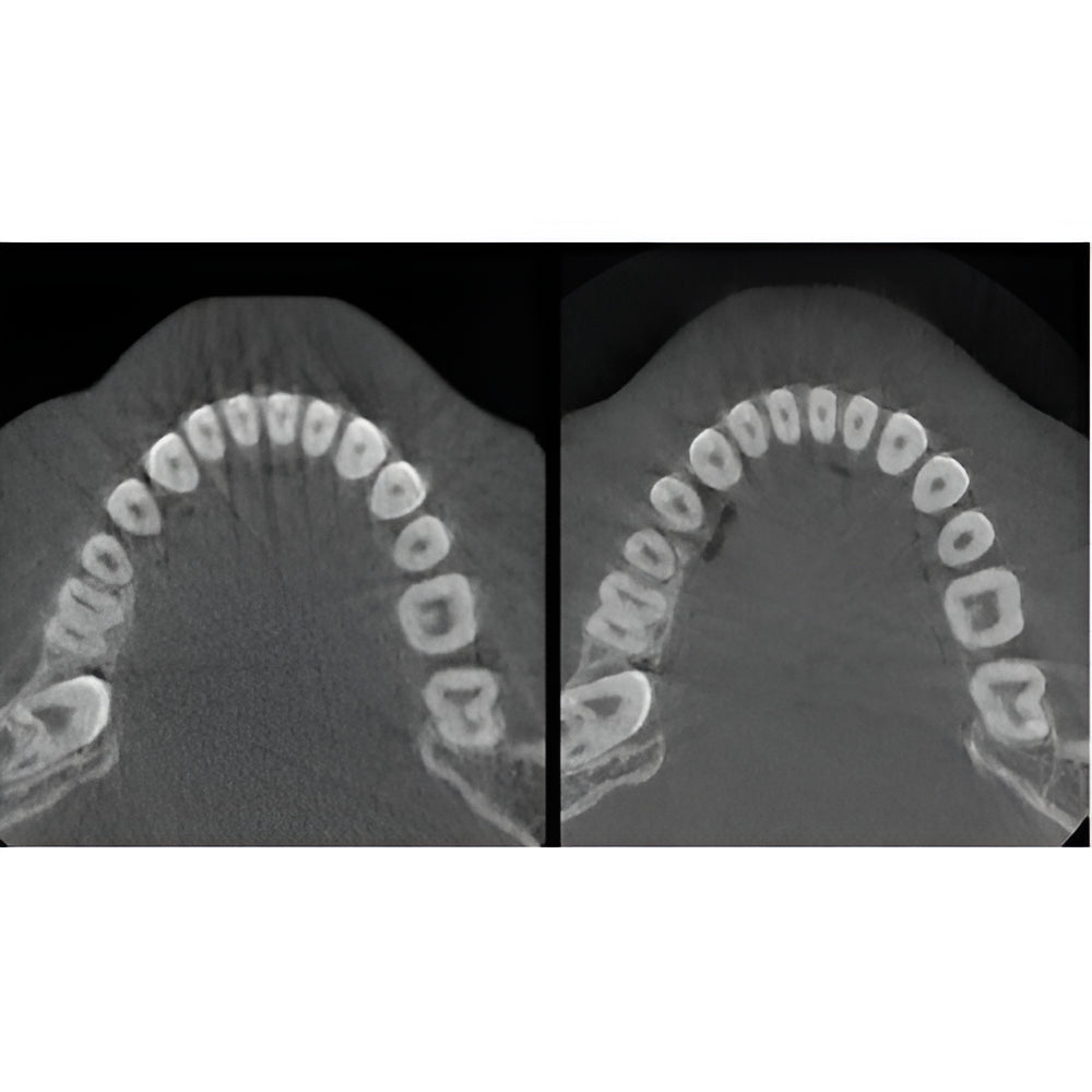 Carestream CS9600 Pan + CBCT (16x10 FOV)