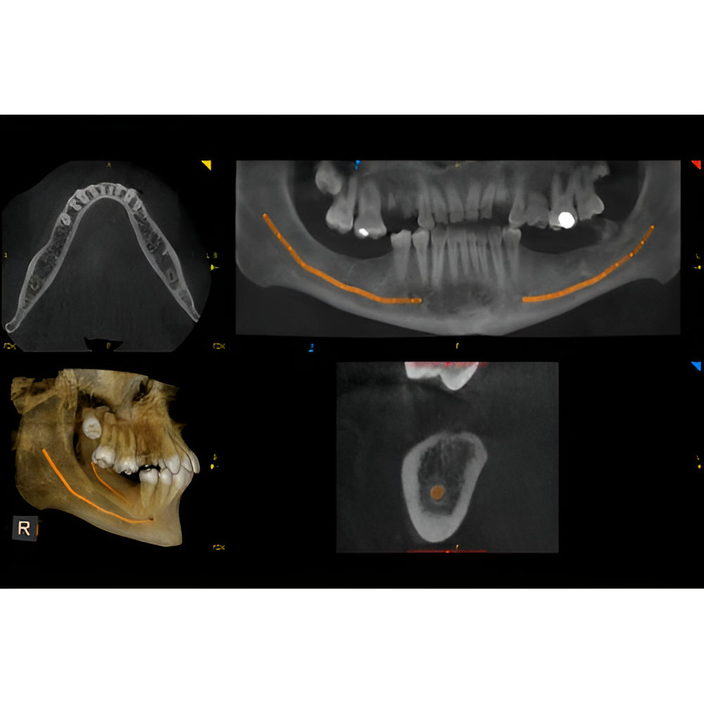 Carestream CS9600 Pan + CBCT (16x10 FOV)