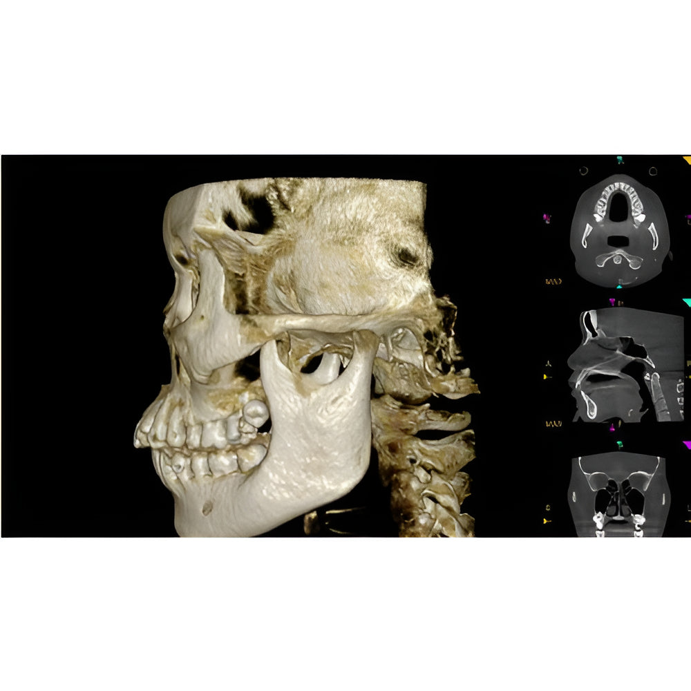 Carestream CS9600 Pan + CBCT (16x10 FOV)