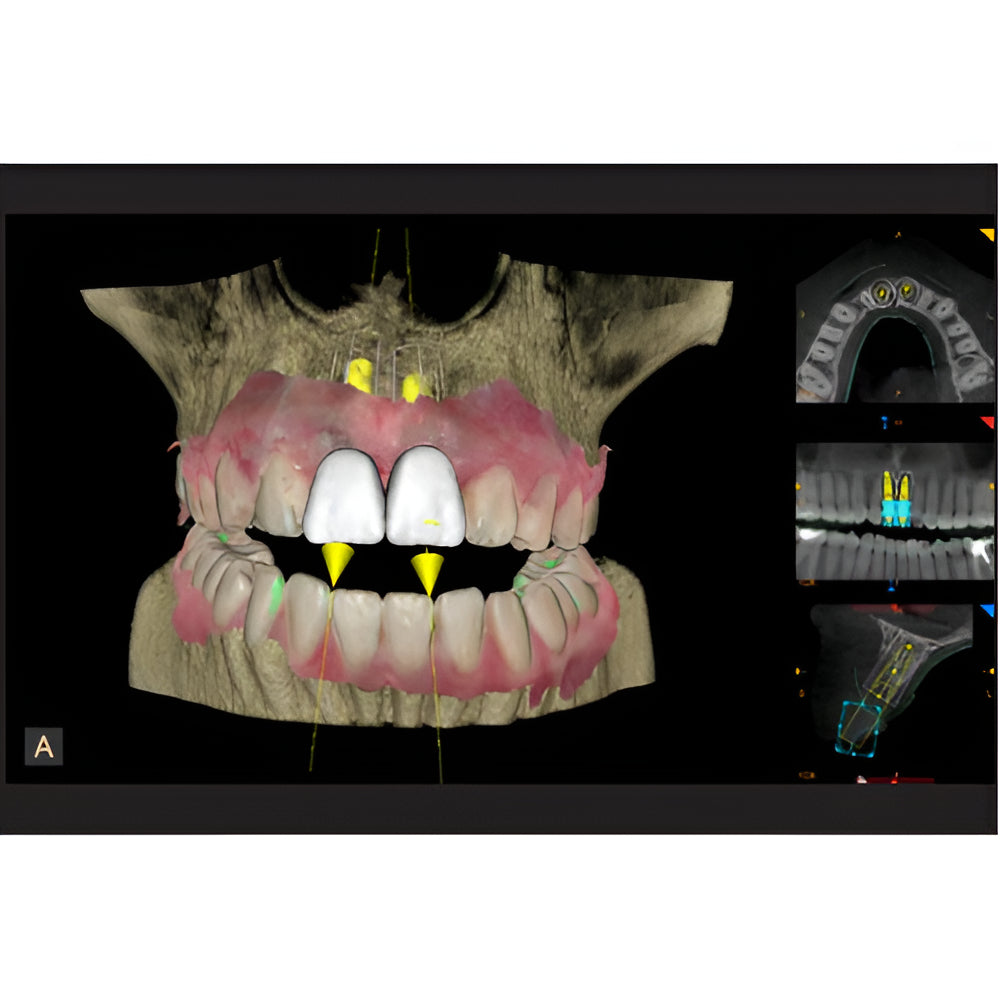 Carestream CS9600 Pan + CBCT (16x10 FOV)