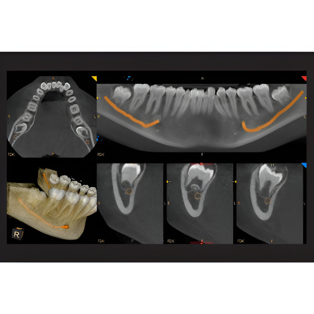 Carestream CS9600 Pan + CBCT (16x10 FOV)